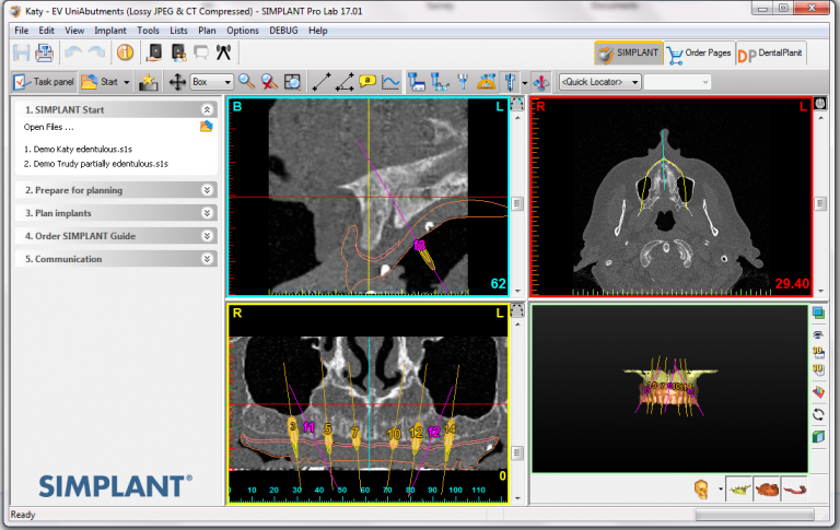 دانلود کرک Simplant pro 17